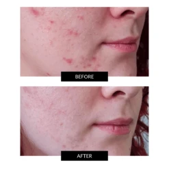 FACEGYM Face Coach Oil (15/30ml) -FOREO || Braun || Therabody Shop 1200x1200 5 1