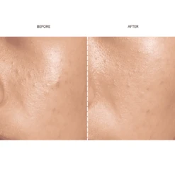 FAQ™ 202 Silicone Mask -FOREO || Braun || Therabody Shop 1 d627b238 76e3 4928 a018 12bc6858695f