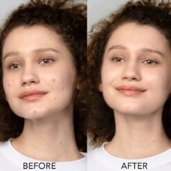 FOREO ESPADA Blue Light Acne Treatment Device -FOREO || Braun || Therabody Shop 7350092130011 08 1 1