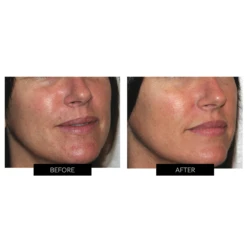 FOREO || Braun || Therabody Shop -FOREO || Braun || Therabody Shop B A1