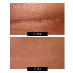 LYMA Laser (Red) System Starter Kit & Free CurrentBody Skin Skincare -FOREO || Braun || Therabody Shop B A 5 1 e52050b5 4ad4 4d0a b2b3 934dd0682449