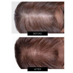 CapillusUltra Laser Cap For Hair Regrowth 16 CapillusUltra Laser Cap For Hair Regrowth -FOREO || Braun || Therabody Shop B A CAPILLUS 1 COM 2 f0d5e13c f1d1 4411 9451 ff14f0d591fb