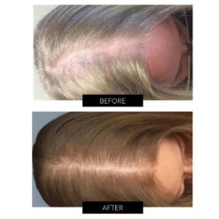 CapillusPlus Hair Regrowth Laser Cap -FOREO || Braun || Therabody Shop B A CAPILLUS 1 COM 3 08038d47 5f6b 4817 9a29 f903b1116df1