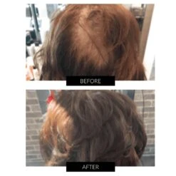 CapillusUltra Laser Cap For Hair Regrowth 19 CapillusUltra Laser Cap For Hair Regrowth -FOREO || Braun || Therabody Shop B A CAPILLUS 1 COM 5 dd18b723 6cd3 4598 a49c 57898ffd7f5a