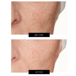 Lancer Skincare The Method: Polish Normal-Combination Skin (Bonus Size 236ml) -FOREO || Braun || Therabody Shop B A TEMPLATEB A 1 COMcopy4 2 1 8c3e3717 aaaa 4501 ae2a 0d2084917c57