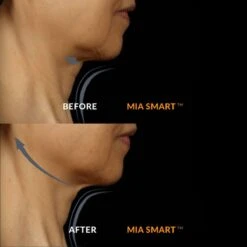 Clarisonic Mia Smart -FOREO || Braun || Therabody Shop CL MIA SMT WHI ECM 013 39a0f282 f88f 4974 83d2 61a4f6b1dcc5