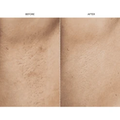 SmoothSkin Pure Fit IPL Hair Removal Device -FOREO || Braun || Therabody Shop Copyof1200x1200