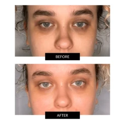 FACEGYM Faceshot Electric Microneedling Device Refill -FOREO || Braun || Therabody Shop Copyof1200x1200 1 aaacc9e4 5e3e 4dce 9645 9dc08842eef8