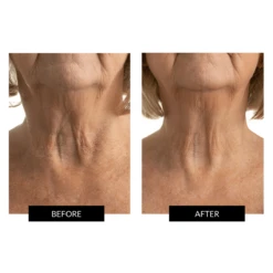 Currentbody Skin Neck And Dec & Neck And Dec Hydrogels X5 -FOREO || Braun || Therabody Shop Copyof1 3 1