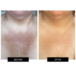 Currentbody Skin Neck And Dec & Neck And Dec Hydrogels X5 -FOREO || Braun || Therabody Shop Copyof1 4 1