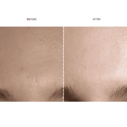 FAQ™ 201 Silicone Mask 14 FAQ™ 201 Silicone Mask -FOREO || Braun || Therabody Shop Copyofsquare 2