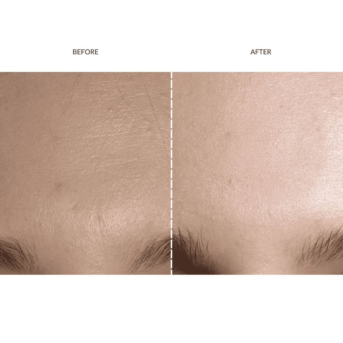 FAQ™ 201 Silicone Mask 7 FAQ™ 201 Silicone Mask - Image 5