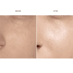 FAQ™ 201 Silicone Mask 13 FAQ™ 201 Silicone Mask -FOREO || Braun || Therabody Shop Copyofsquare