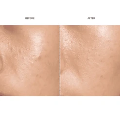 FAQ™ 201 Silicone Mask 17 FAQ™ 201 Silicone Mask -FOREO || Braun || Therabody Shop Copyofsquare 4