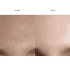 FAQ™ 202 Silicone Mask -FOREO || Braun || Therabody Shop Copyofsquare 5