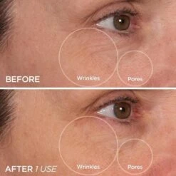 BeautyBio Cryo Roller 10 BeautyBio Cryo Roller -FOREO || Braun || Therabody Shop Cryo Dual B A1 2000x 480x480 5de6362a fddd 45ba b2f0 eff4f372241f