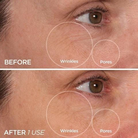 BeautyBio Cryo Roller 6 BeautyBio Cryo Roller - Image 4