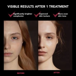 FAQ™ 201 Silicone Mask 12 FAQ™ 201 Silicone Mask -FOREO || Braun || Therabody Shop FAQ201 Before After 1