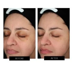 FAQ™ 101 RF Radio Frequency & LED Device -FOREO || Braun || Therabody Shop FAQsMASTER.psdB A 1 COMcopy2 1