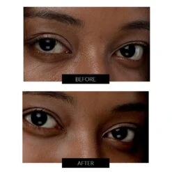 FOREO IRIS 2 Rejuvenating Eye Massager 10 FOREO IRIS 2 Rejuvenating Eye Massager -FOREO || Braun || Therabody Shop FO F0644 GL ECM 004