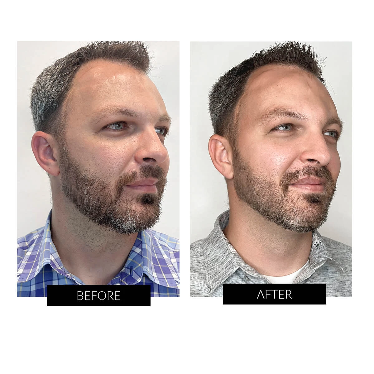 FOREO LUNA 4 Men Smart Facial Cleansing & Firming Device 7 FOREO LUNA 4 Men Smart Facial Cleansing & Firming Device - Image 5