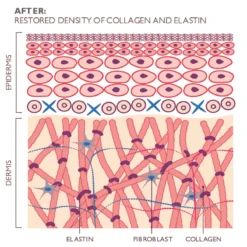 Silk'n FaceTite Revive -FOREO || Braun || Therabody Shop FaceTite Illustration EN after copy