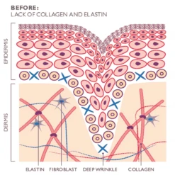Silk'n FaceTite Revive -FOREO || Braun || Therabody Shop FaceTite Illustration beforecopy