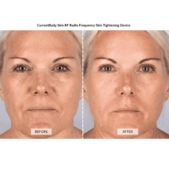 CurrentBody Skin Complete Anti-Ageing Facial Kit -FOREO || Braun || Therabody Shop KELLY.W 1 1 90cbcfa6 3a4f 4a26 8a1a 92a512eb7a07