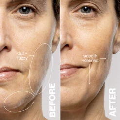 DERMAFLASH LUXE+ Anti-Ageing, Exfoliation + Peach Fuzz Removal Device -FOREO || Braun || Therabody Shop LUXE 2000x2000 Stone 4 1