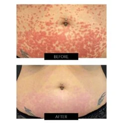 Dermalux Flex MD LED Light Therapy Device -FOREO || Braun || Therabody Shop MasterpsdB A 1 COMcopy2 1 1