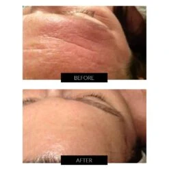 Dermalux Flex MD LED Light Therapy Device -FOREO || Braun || Therabody Shop MasterpsdB A 1 COMcopy2 2 1