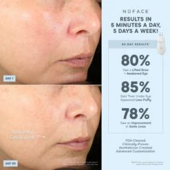 NuFACE TRINITY+ Effective Lip & Eye Attachment -FOREO || Braun || Therabody Shop NF TRINITYELE PDP Benefits BA 1x1 43b8b300 fa0c 4bdc 8ae1 48552f6ffc78