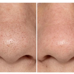 BeautyBio GLOfacial Hydro-Infusion Pore Cleansing Tool -FOREO || Braun || Therabody Shop beautybio5 1