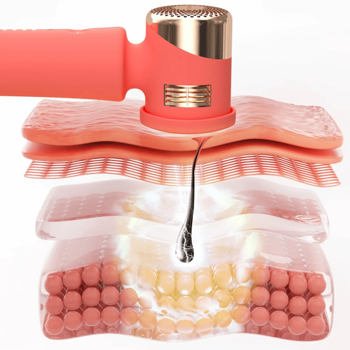 FOREO PEACH 2 Advanced IPL Hair Removal Device 7 FOREO PEACH 2 Advanced IPL Hair Removal Device - Image 5